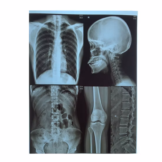 X Ray Medical Dry Film X-ray for Hospital Devices Laser/Inkjet Printing