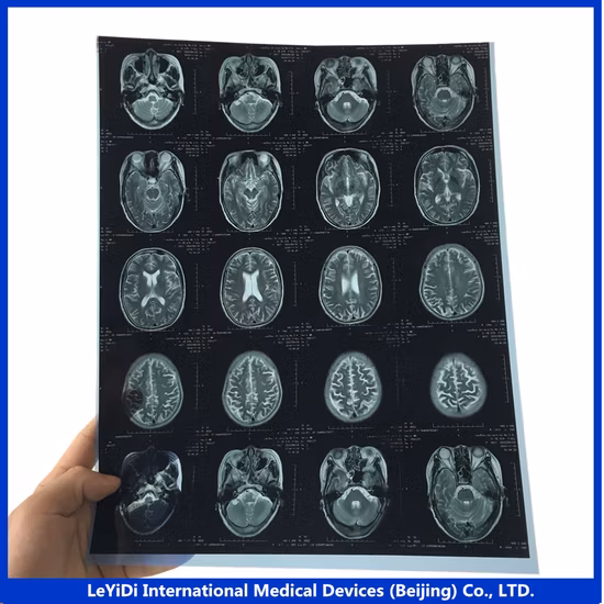 8X10 A3 A4 Pet Radiologia/ Ultrassom 180um jato de tinta azul/Laser Medical X